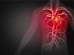 Heart Diseases Caused by a Healthy Lifestyle Lifestyle