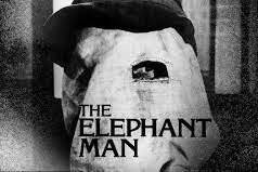 The Hollywood star who missed the David Lynch film “The Elephant Man” Hollywood