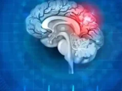 Lifestyle choices that may make brain strokes more likely